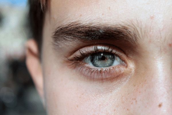 stożek rogówki – co to za choroba, jak się objawia i jak się ją leczy