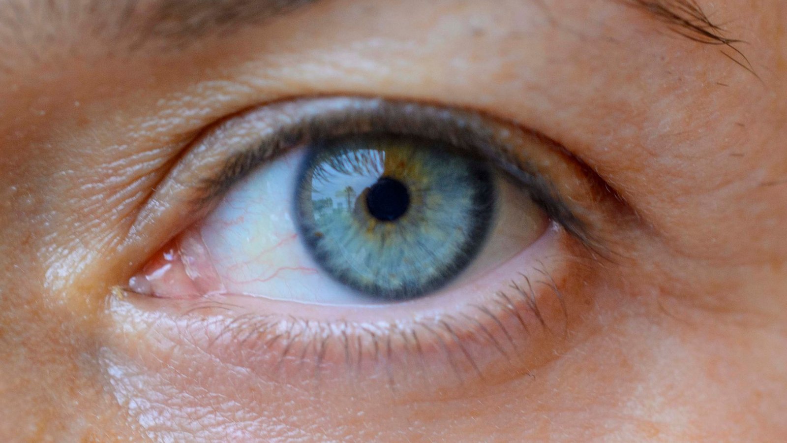 odwarstwienie siatkówki oka